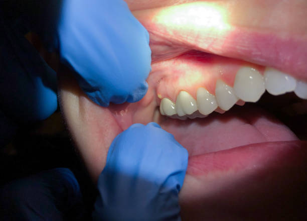 Best Walk-In Emergency Dentist in San Antonio Heights, CA