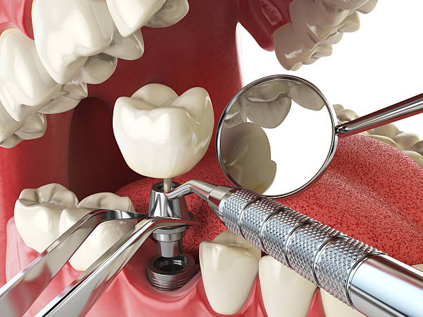 Best After-Hours Emergency Dentist in San Antonio Heights, CA